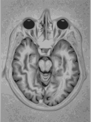 Brain MRI Vector representation
